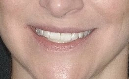 before dental procedure from magnificent mile 3