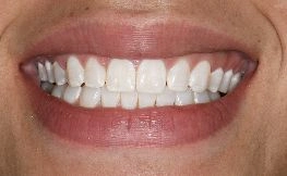 before dental procedure from magnificent mile 1